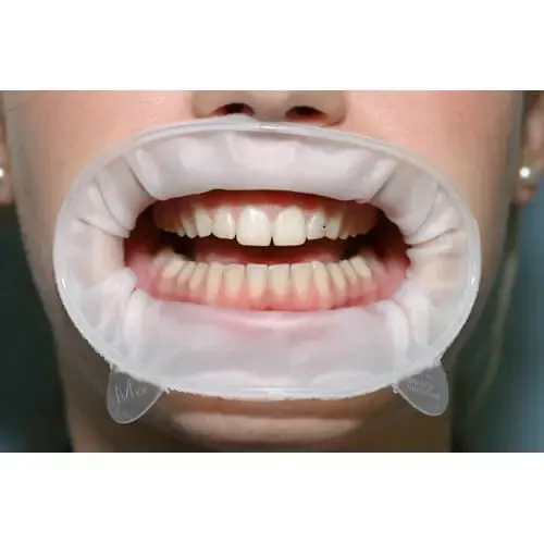 Optragate 3D Small 80pcs